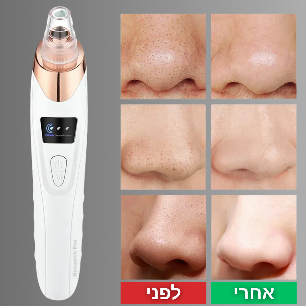 מסיר שחורים חשמלי - ™Novanith Pro