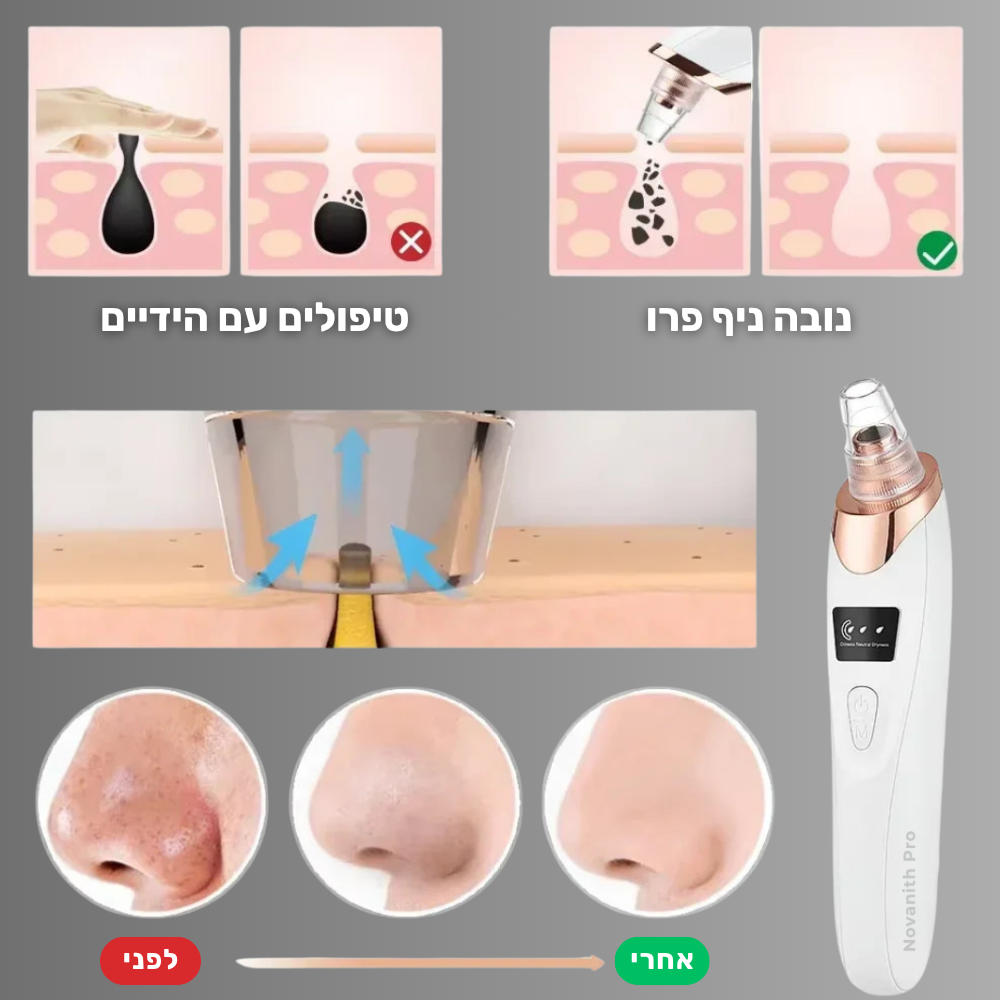 מסיר שחורים חשמלי - ™Novanith Pro