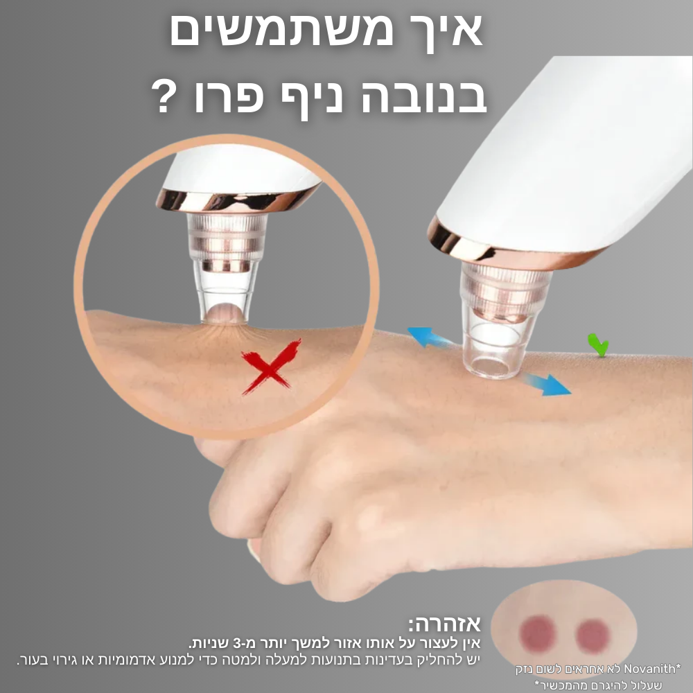 מסיר שחורים חשמלי - ™Novanith Pro