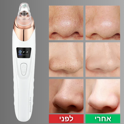המארז המלא לטיפול עור הפנים מהבית - ™Novanith Kit